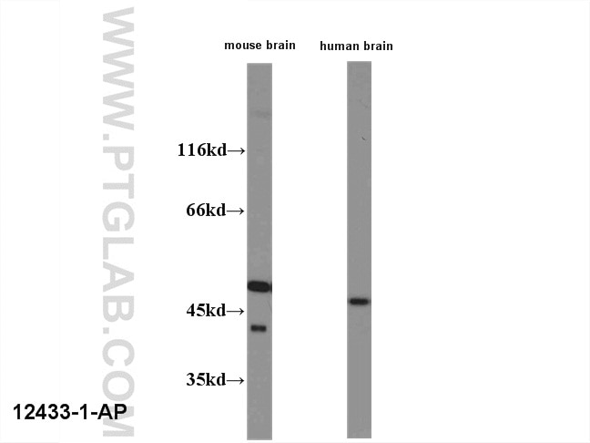 Western Blot (WB) analysis of human/mouse brain using HOMER1 Polyclonal antibody (12433-1-AP)