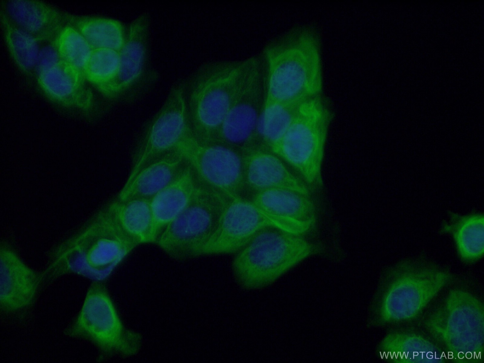 Immunofluorescence (IF) / fluorescent staining of MCF-7 cells using HOMER1 Polyclonal antibody (12433-1-AP)