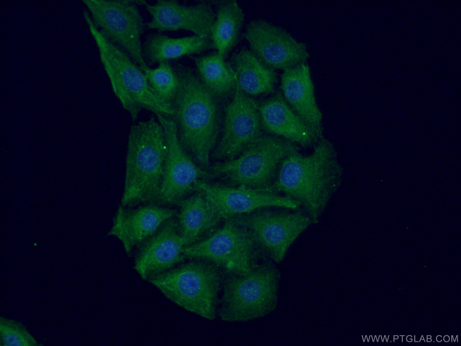 Immunofluorescence (IF) / fluorescent staining of SH-SY5Y cells using HOMER1 Polyclonal antibody (12433-1-AP)