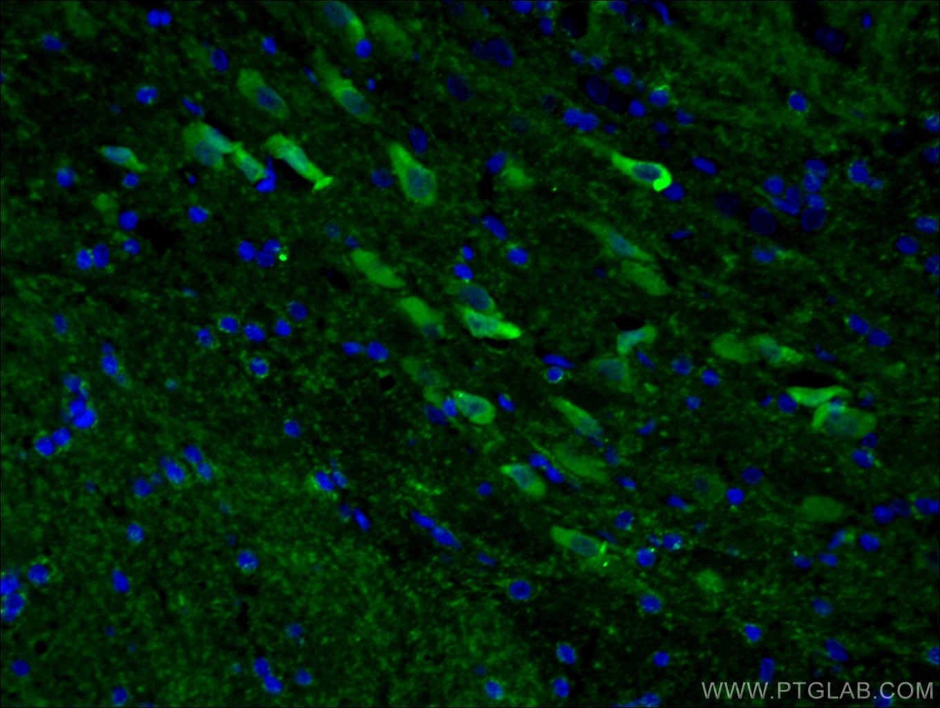 Immunofluorescence (IF) / fluorescent staining of rat brain tissue using HOMER1 Polyclonal antibody (12433-1-AP)