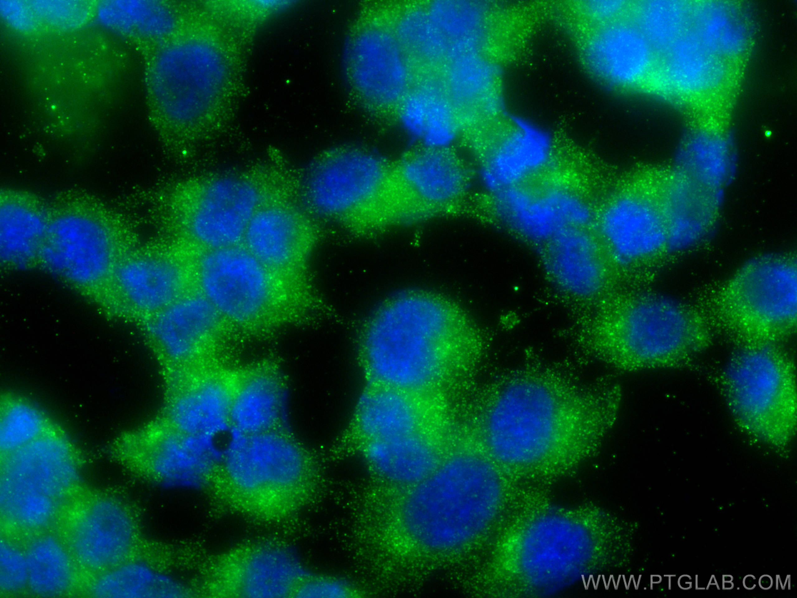 Immunofluorescence (IF) / fluorescent staining of PC-12 cells using HOMER1 Polyclonal antibody (12433-1-AP)