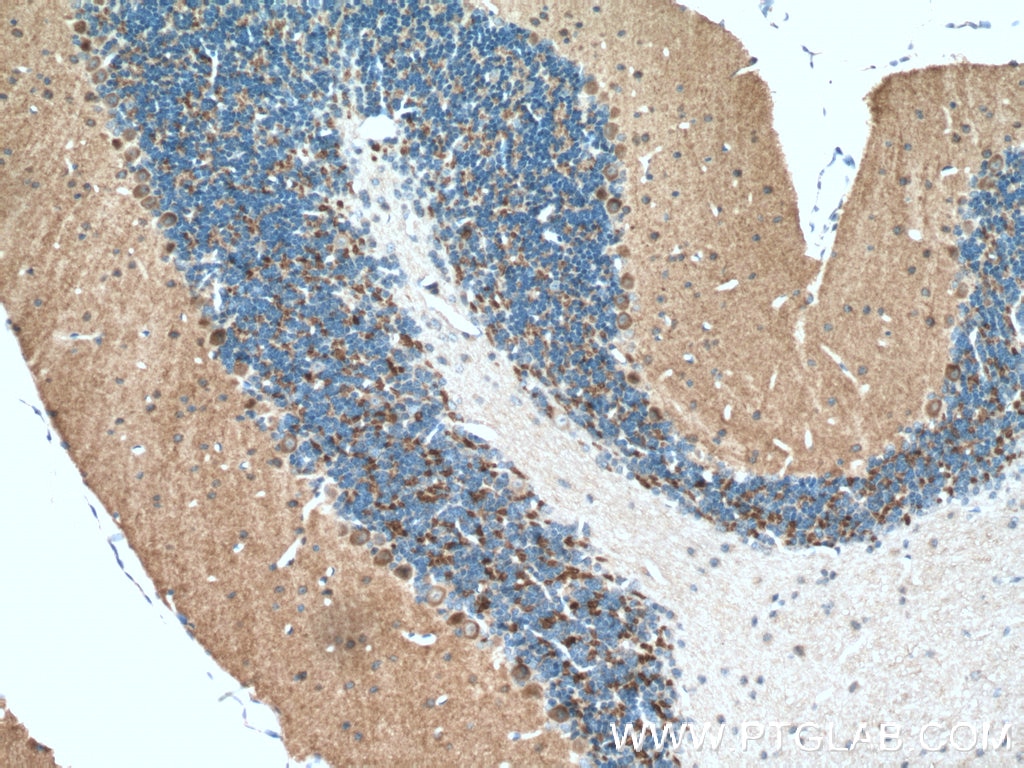 Immunohistochemistry (IHC) staining of mouse brain tissue using HOMER1 Polyclonal antibody (12433-1-AP)