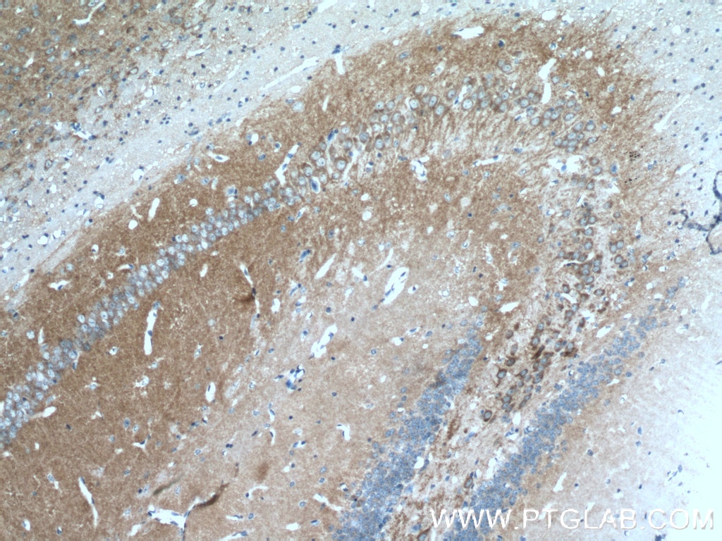 Immunohistochemistry (IHC) staining of mouse brain tissue using HOMER1 Polyclonal antibody (12433-1-AP)