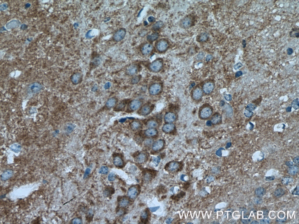 Immunohistochemistry (IHC) staining of mouse brain tissue using HOMER1 Polyclonal antibody (12433-1-AP)