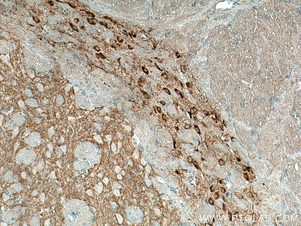 Immunohistochemistry (IHC) staining of rat brain tissue using HOMER1 Polyclonal antibody (12433-1-AP)