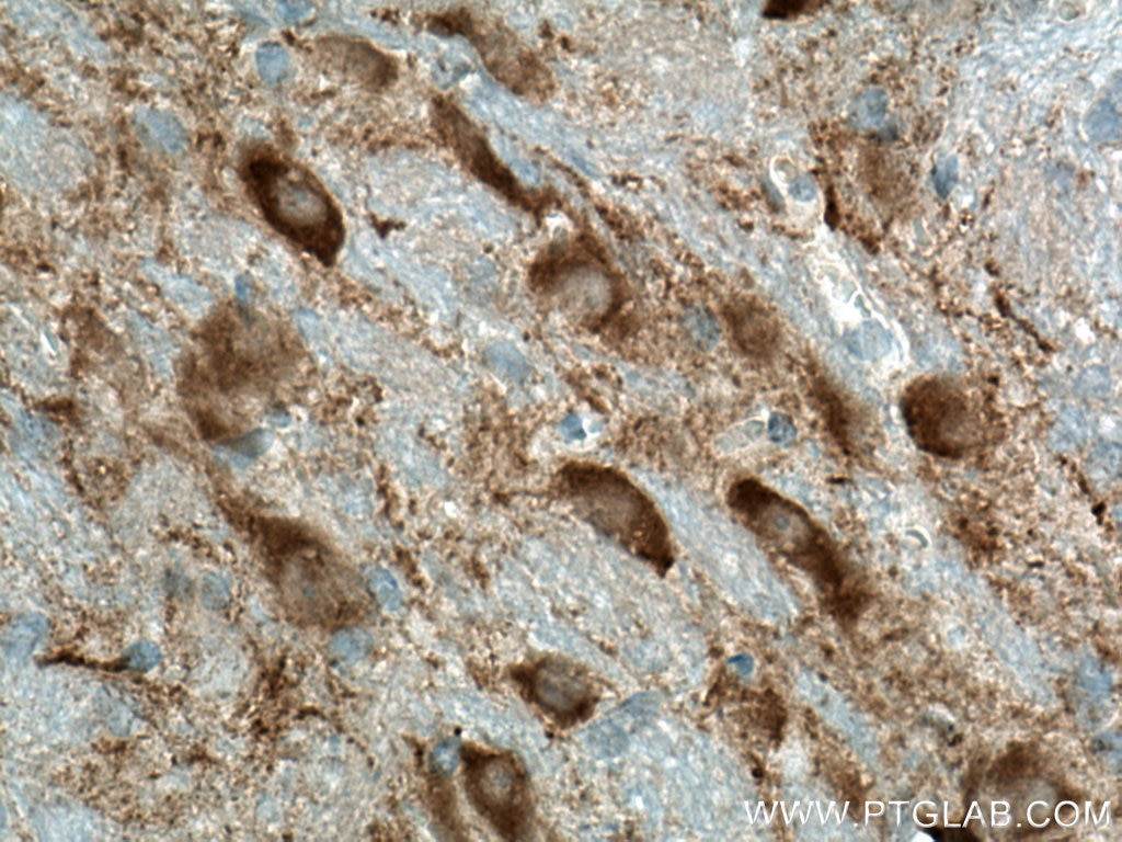 Immunohistochemistry (IHC) staining of rat brain tissue using HOMER1 Polyclonal antibody (12433-1-AP)