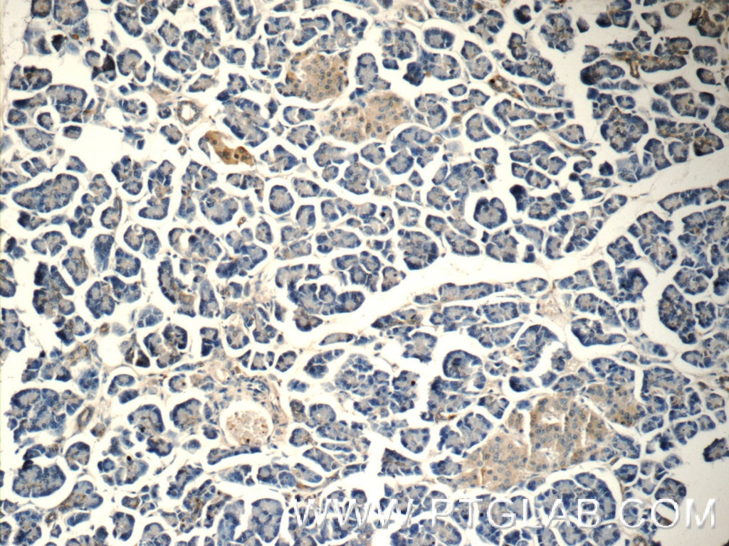 Immunohistochemistry (IHC) staining of human pancreas tissue using HOMER1 Polyclonal antibody (12433-1-AP)