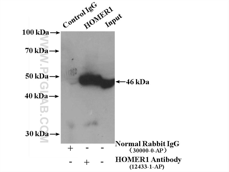 Immunoprecipitation (IP) experiment of fetal human brain tissue using HOMER1 Polyclonal antibody (12433-1-AP)