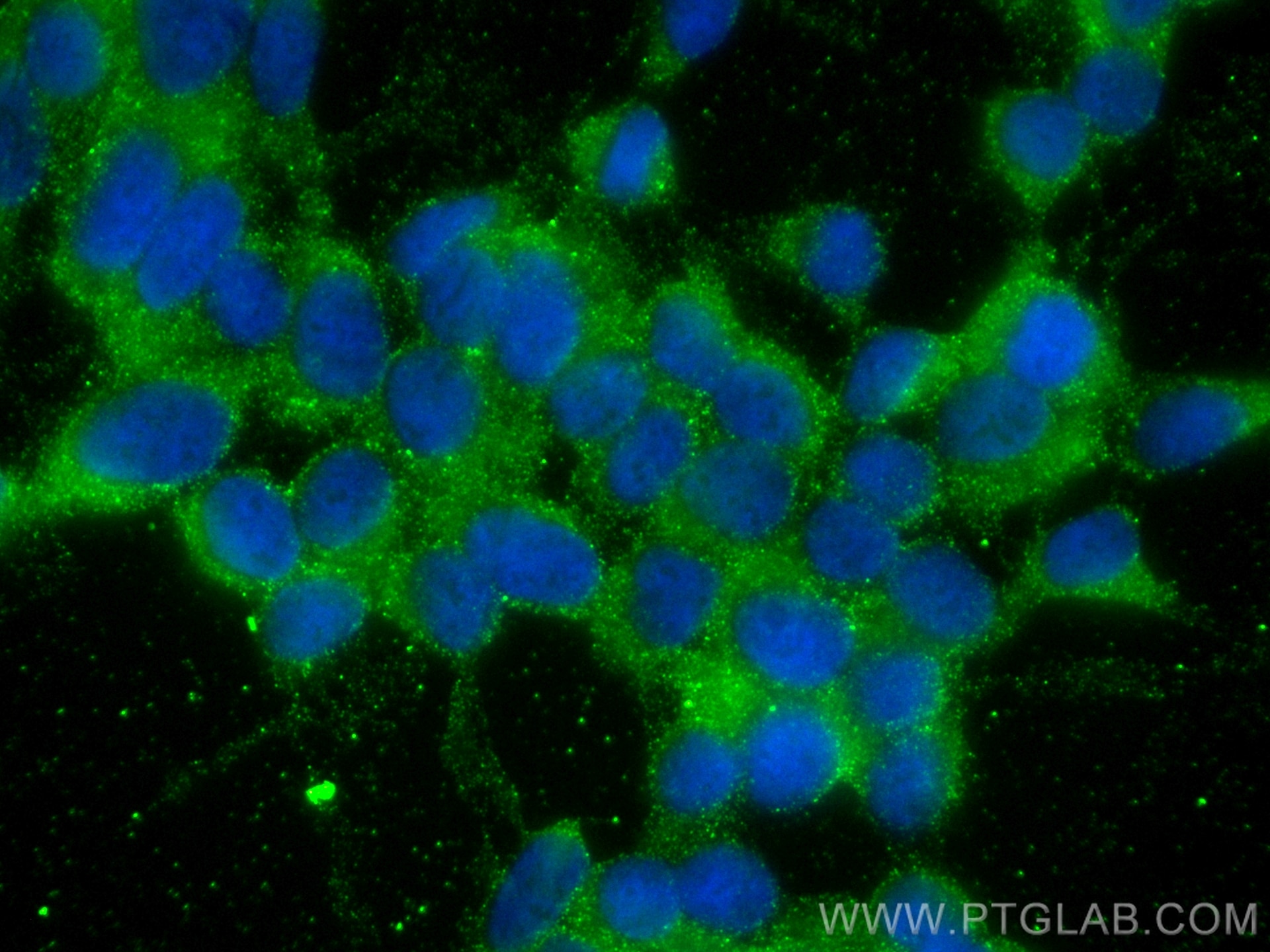 Immunofluorescence (IF) / fluorescent staining of SH-SY5Y cells using HOMER1 Monoclonal antibody (68597-1-Ig)