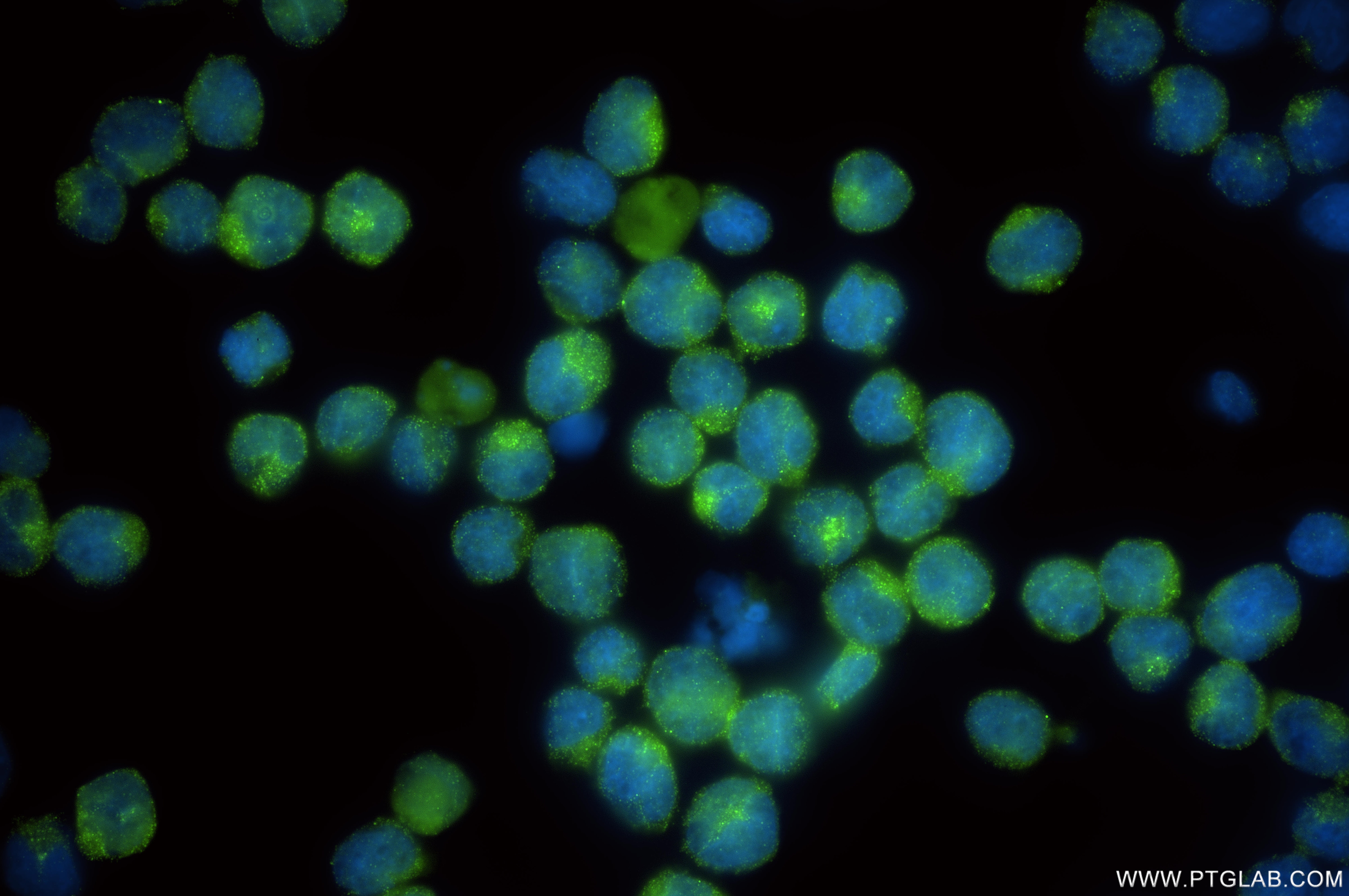 Immunofluorescence (IF) / fluorescent staining of MOLT-4 cells using HOMER1 Recombinant monoclonal antibody (85692-4-RR)