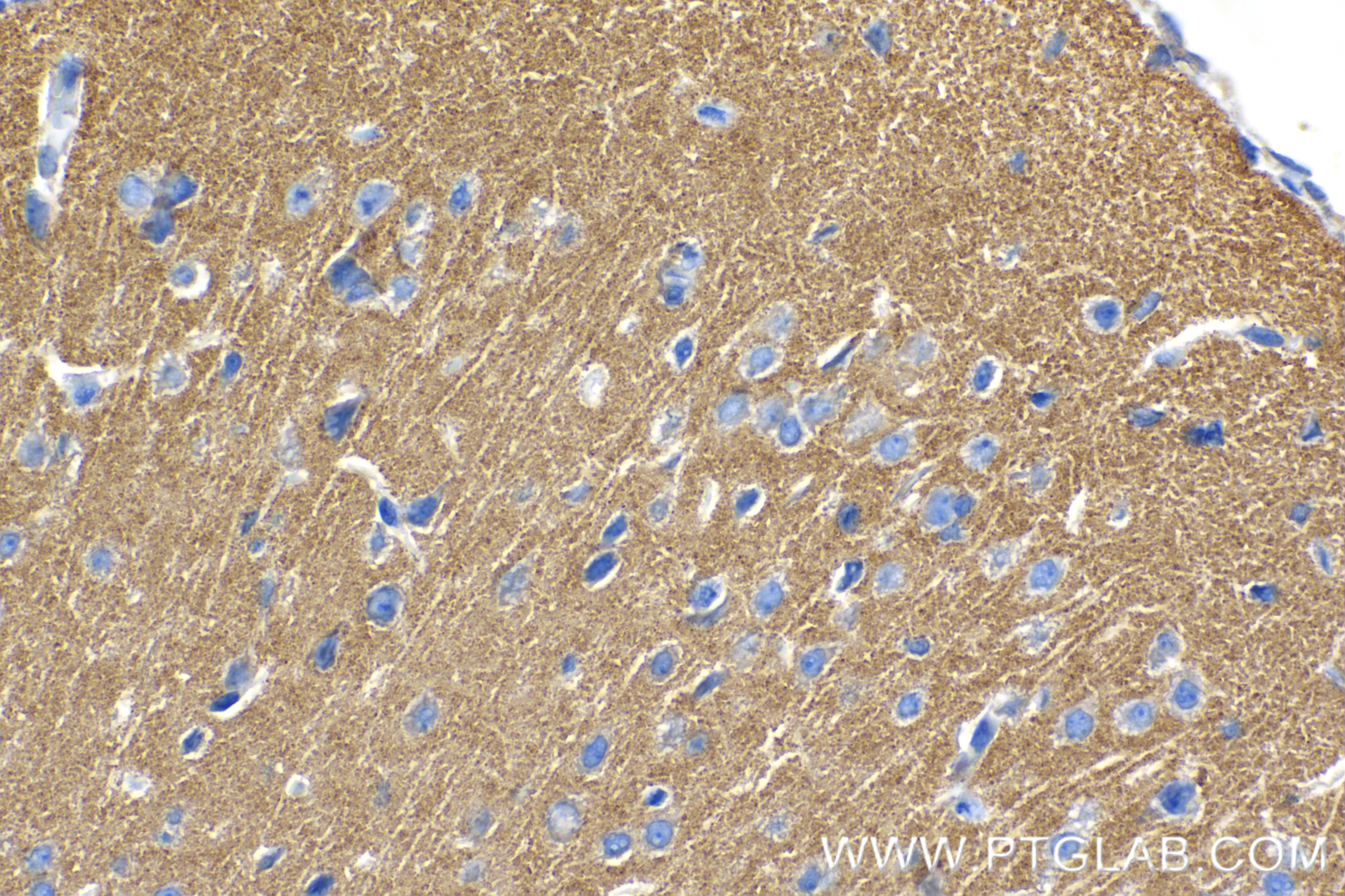 Immunohistochemistry (IHC) staining of mouse brain tissue using HOMER1 Recombinant antibody (85692-4-RR)