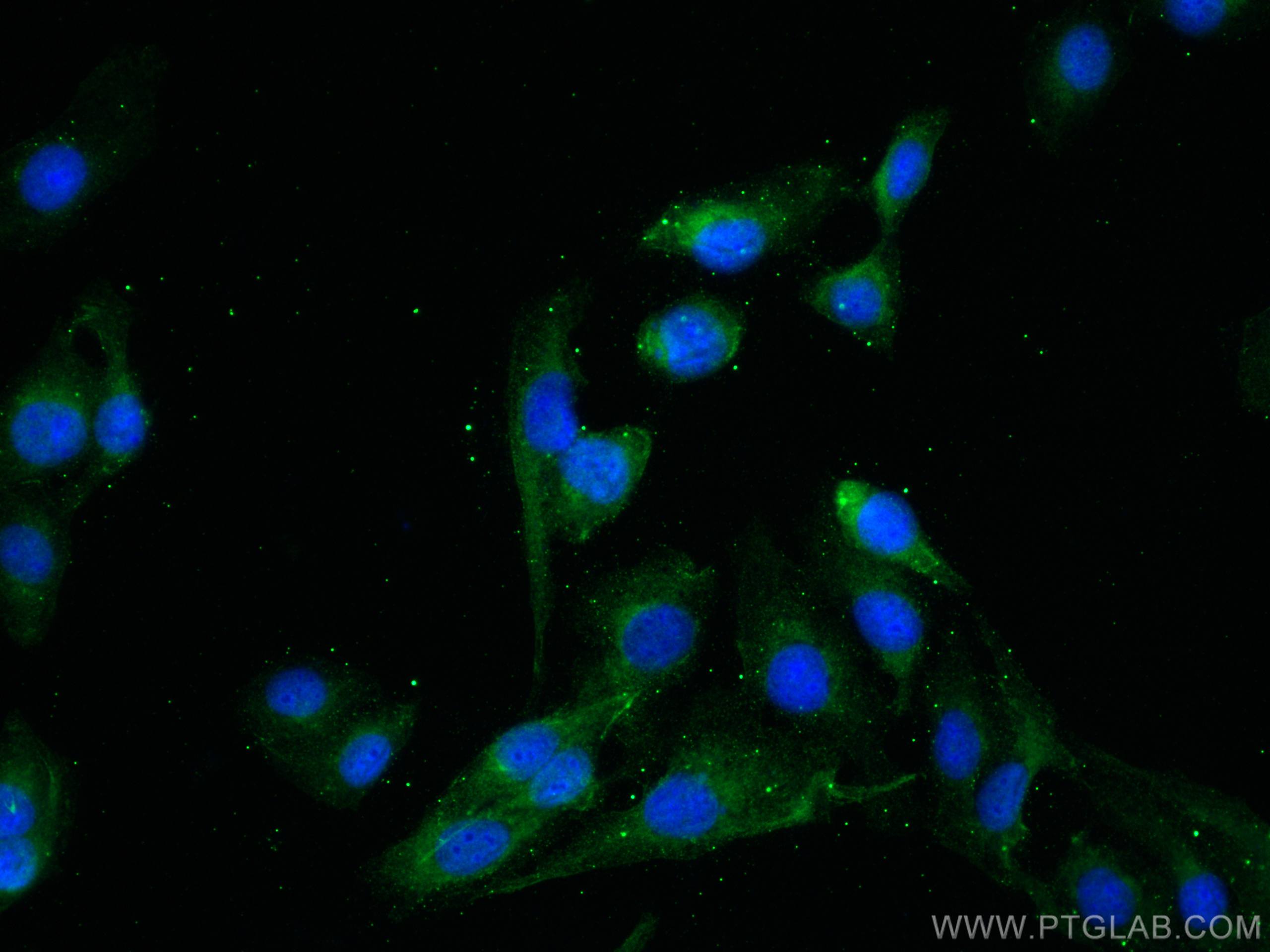 Immunofluorescence (IF) / fluorescent staining of U2OS cells using HOMER2 Polyclonal antibody (11143-1-AP)