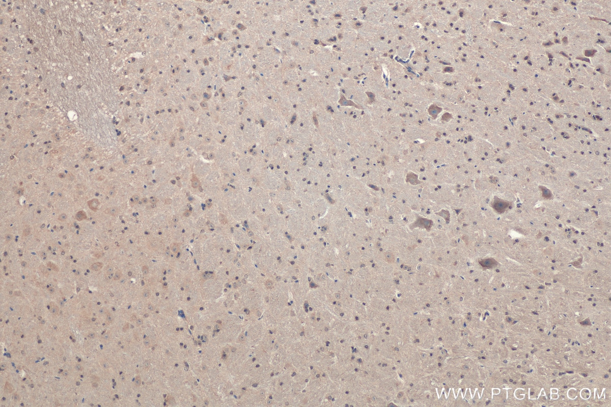 Immunohistochemistry (IHC) staining of mouse cerebellum tissue using HOMER2 Polyclonal antibody (11143-1-AP)