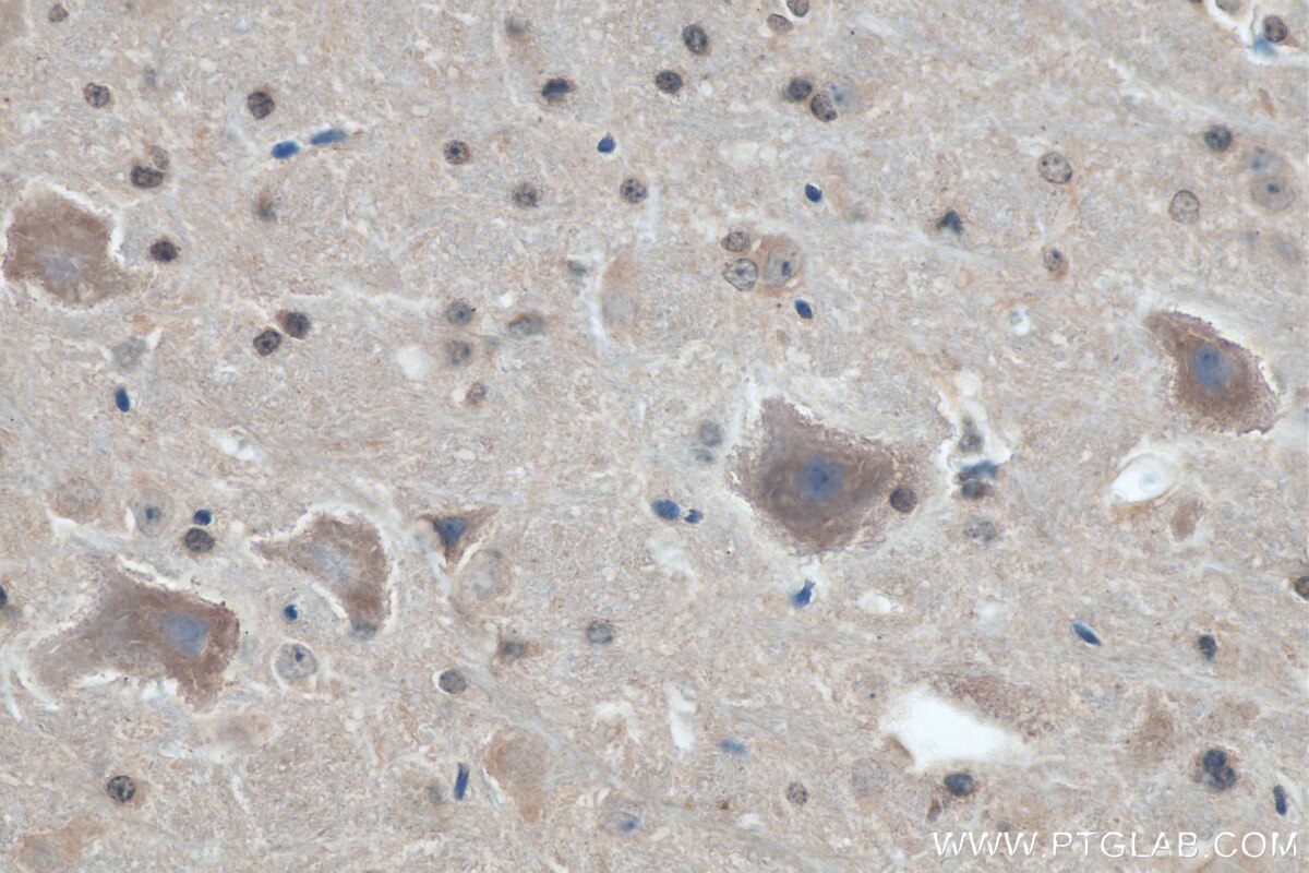 Immunohistochemistry (IHC) staining of mouse cerebellum tissue using HOMER2 Polyclonal antibody (11143-1-AP)