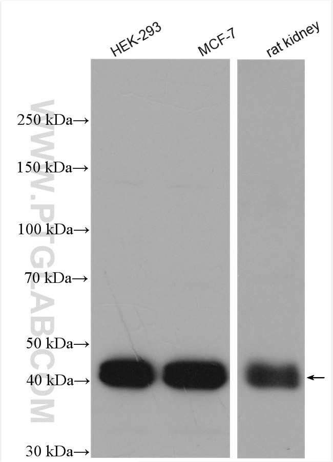 Western Blot (WB) analysis of various lysates using HOMER2 Polyclonal antibody (11143-1-AP)