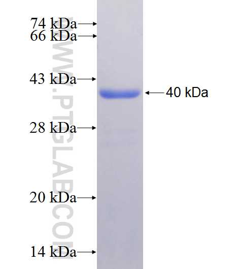 HOMER2 fusion protein Ag25177 SDS-PAGE