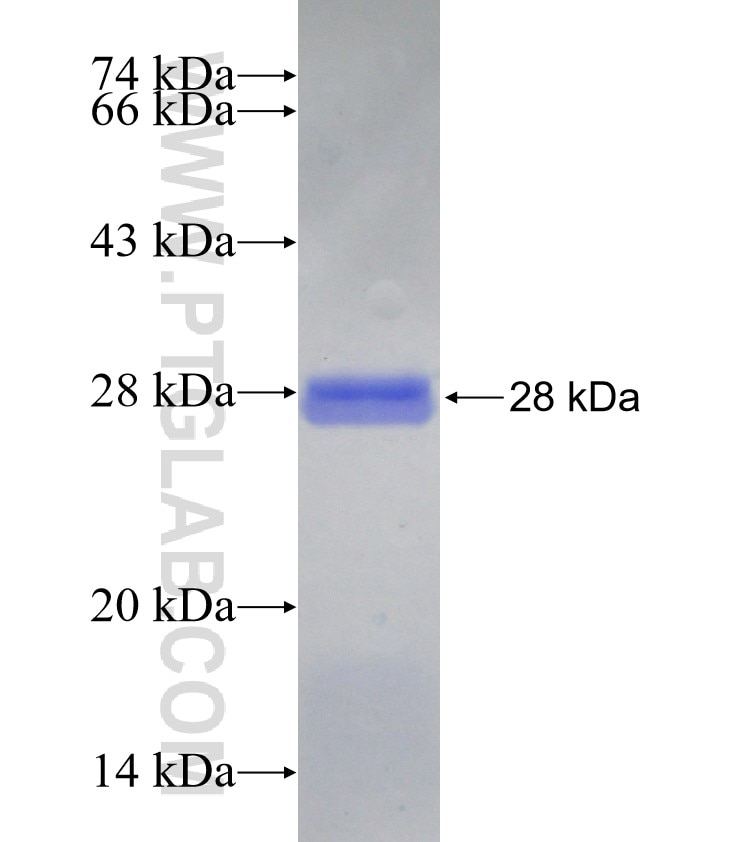 HOMER2 fusion protein Ag29735 SDS-PAGE