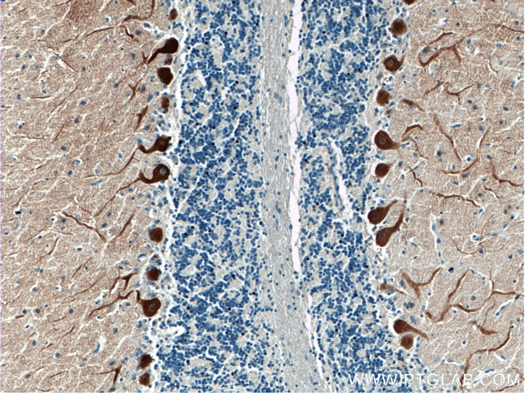 IHC staining of human cerebellum using 16624-1-AP