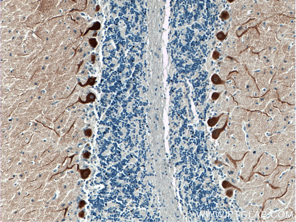 Immunohistochemistry (IHC) staining of human cerebellum tissue using HOMER3 Polyclonal antibody (16624-1-AP)