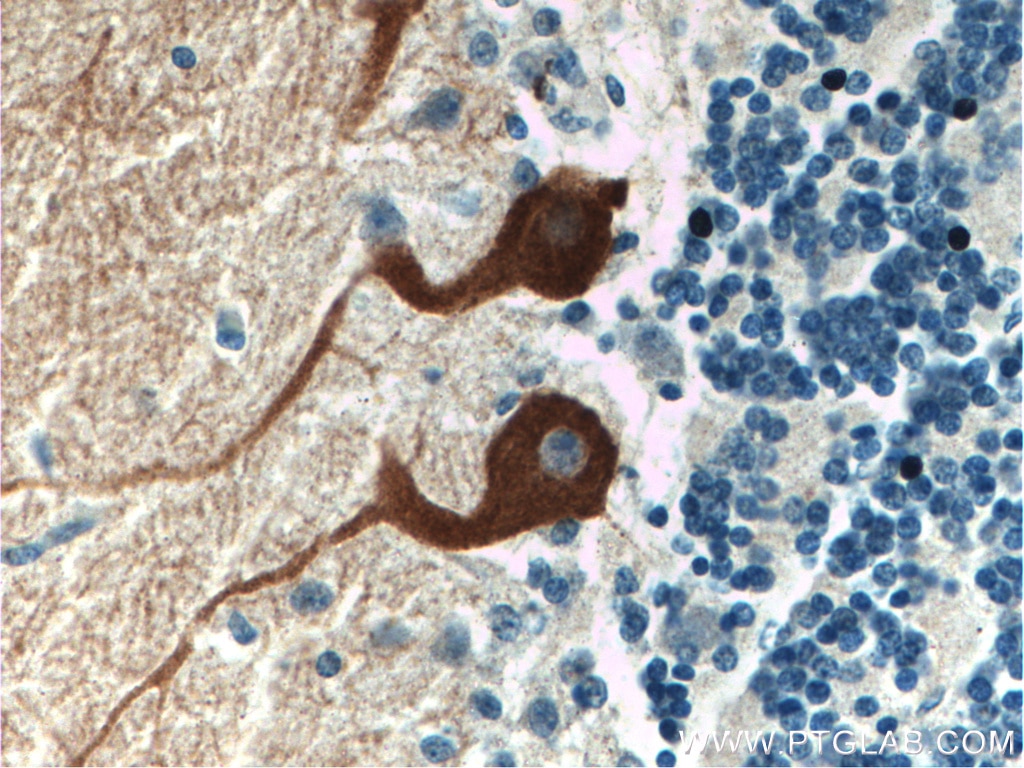 Immunohistochemistry (IHC) staining of human cerebellum tissue using HOMER3 Polyclonal antibody (16624-1-AP)