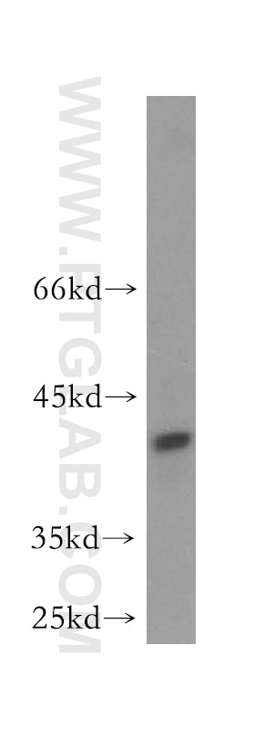 Western Blot (WB) analysis of human brain tissue using HOMER3 Polyclonal antibody (16624-1-AP)