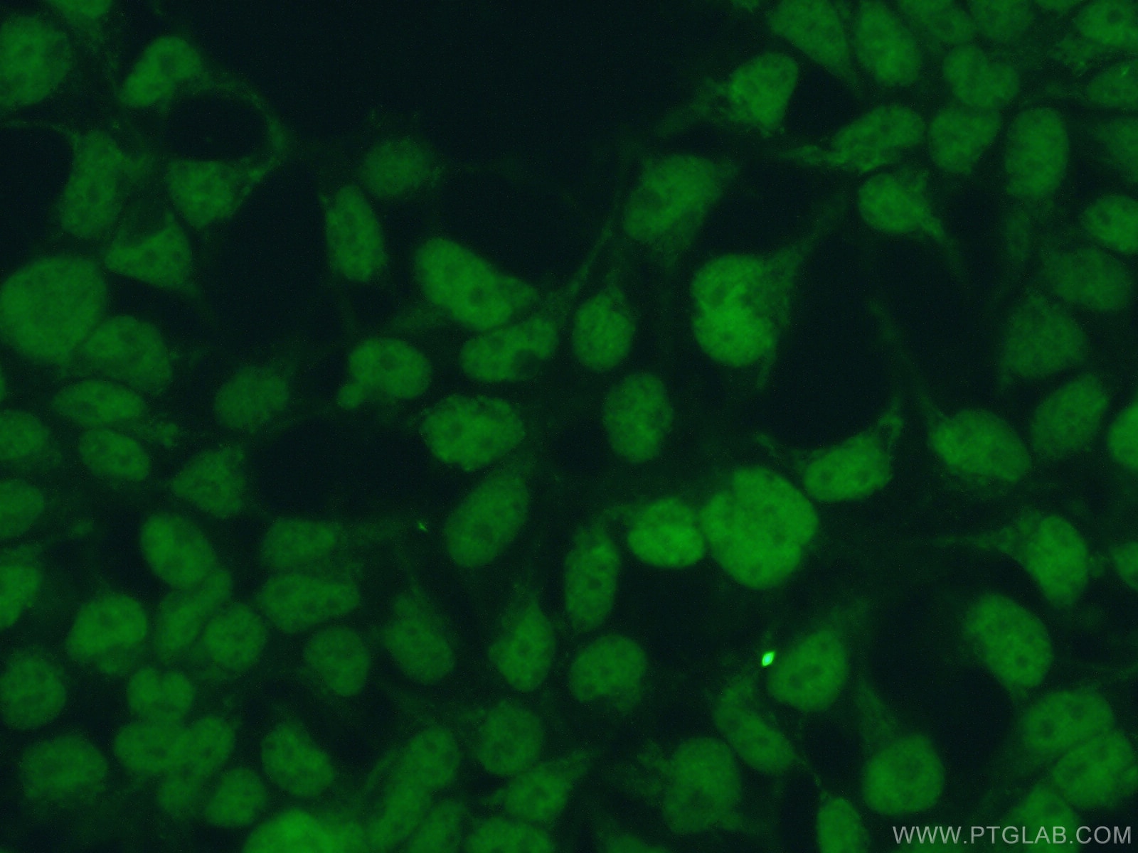 Immunofluorescence (IF) / fluorescent staining of HEK-293 cells using HOMEZ Polyclonal antibody (23965-1-AP)