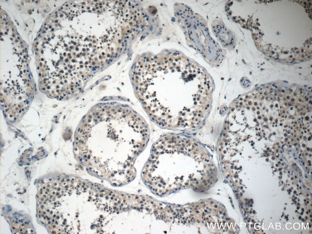 Immunohistochemistry (IHC) staining of human testis tissue using HOMEZ Polyclonal antibody (23965-1-AP)