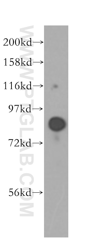 Western Blot (WB) analysis of human brain tissue using HOOK1 Polyclonal antibody (10871-1-AP)