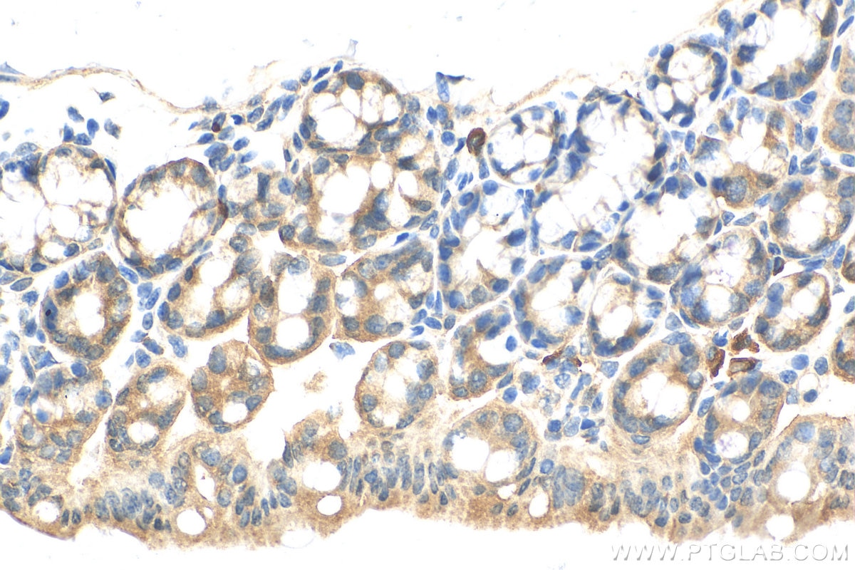Immunohistochemistry (IHC) staining of mouse colon tissue using HOOK2 Polyclonal antibody (12458-1-AP)