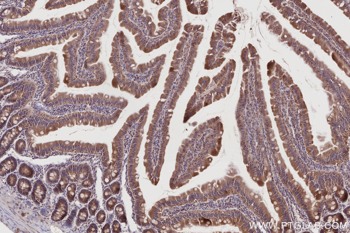 IHC staining of rat small intestine using 32110-1-AP Immunohistochemistry (IHC) staining of rat small intestine tissue using HOOK2 Polyclonal antibody (32110-1-AP)