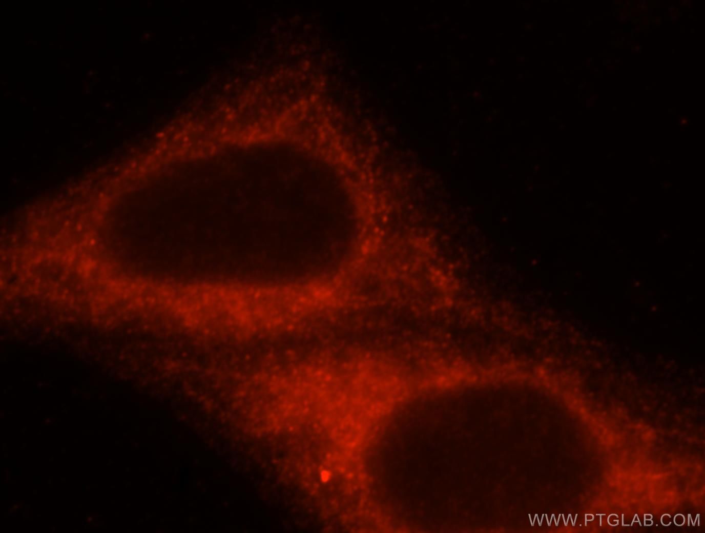 Immunofluorescence (IF) / fluorescent staining of HepG2 cells using HOOK3 Polyclonal antibody (15457-1-AP)