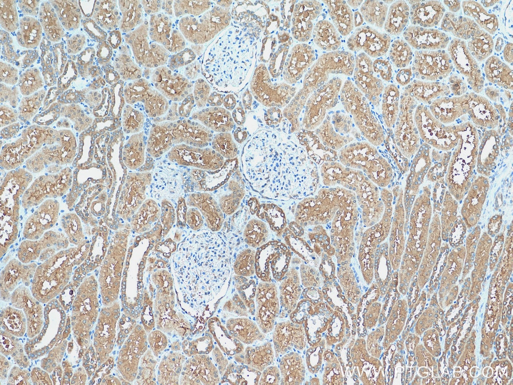 Immunohistochemistry (IHC) staining of human kidney tissue using HOOK3 Polyclonal antibody (15457-1-AP)