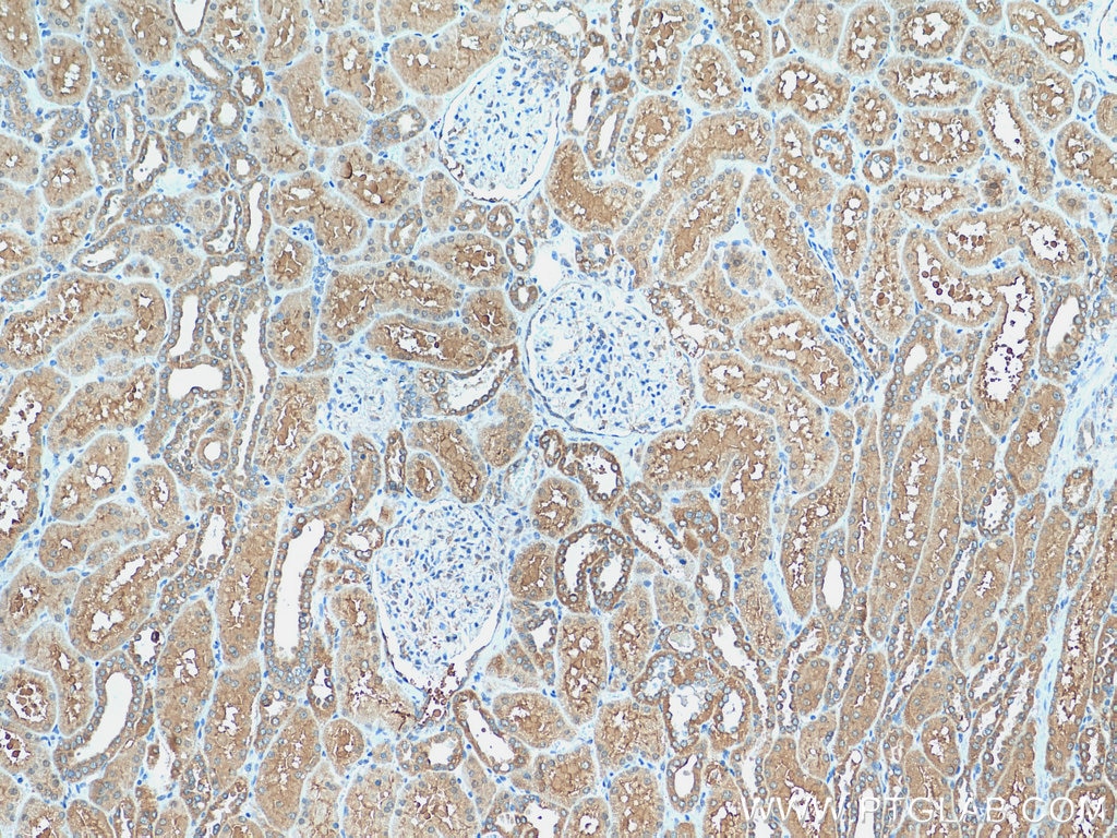 IHC staining of human kidney using 15457-1-AP