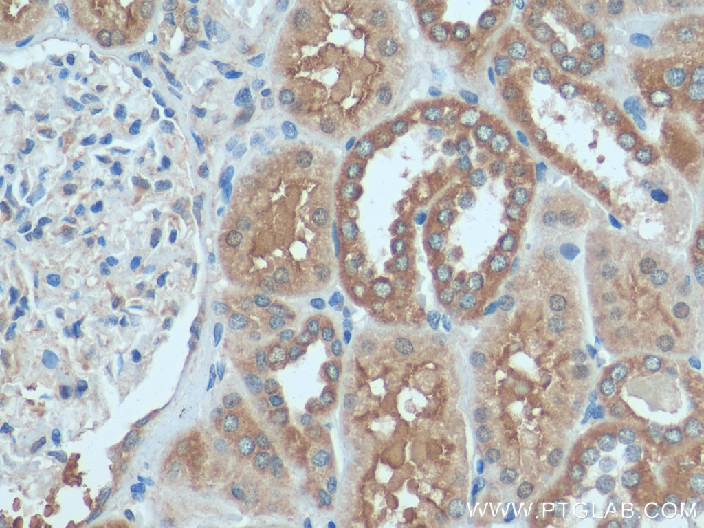 Immunohistochemistry (IHC) staining of human kidney tissue using HOOK3 Polyclonal antibody (15457-1-AP)