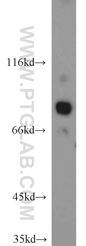 Western Blot (WB) analysis of mouse kidney tissue using HOOK3 Polyclonal antibody (15457-1-AP)
