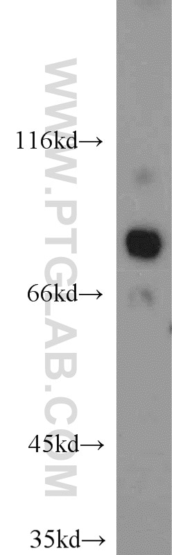 WB analysis of mouse kidney using 15457-1-AP