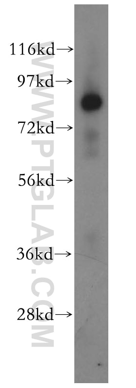 Western Blot (WB) analysis of human liver tissue using HOOK3 Polyclonal antibody (15457-1-AP)