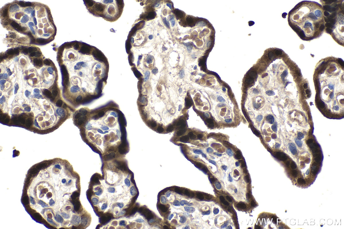 Immunohistochemistry (IHC) staining of human placenta tissue using HOPX Polyclonal antibody (11419-1-AP)
