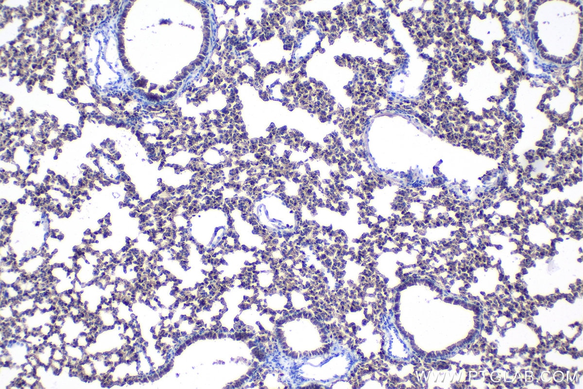 Immunohistochemistry (IHC) staining of mouse lung tissue using HOPX Polyclonal antibody (11419-1-AP)