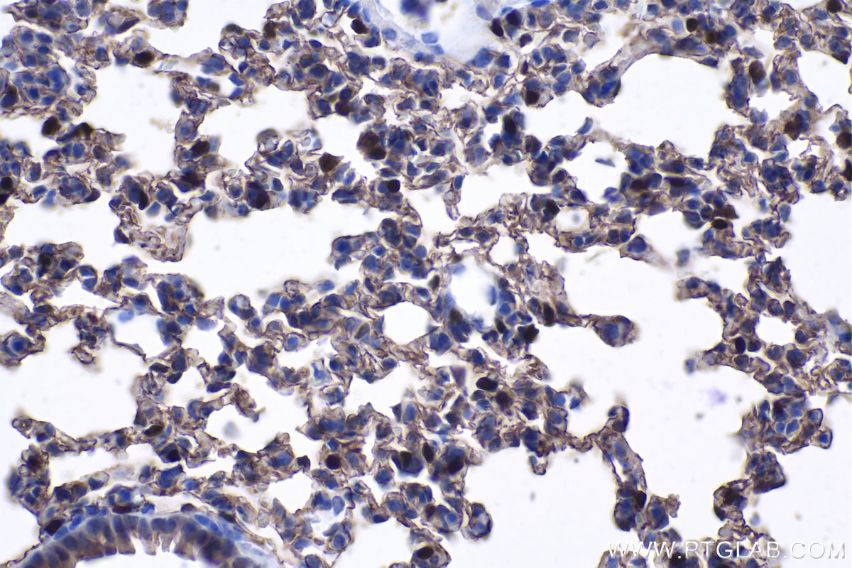 Immunohistochemistry (IHC) staining of mouse lung tissue using HOPX Polyclonal antibody (11419-1-AP)
