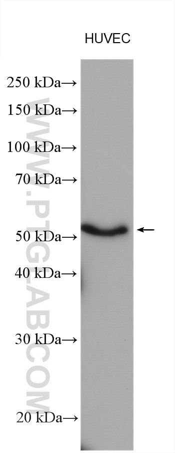 Western Blot (WB) analysis of various lysates using HORMAD1 Polyclonal antibody (13917-1-AP)