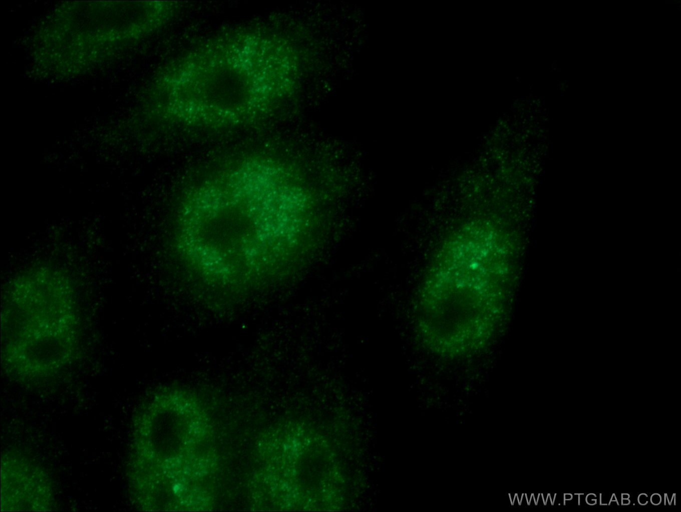 Immunofluorescence (IF) / fluorescent staining of HepG2 cells using HORMAD1 Monoclonal antibody (67091-1-Ig)