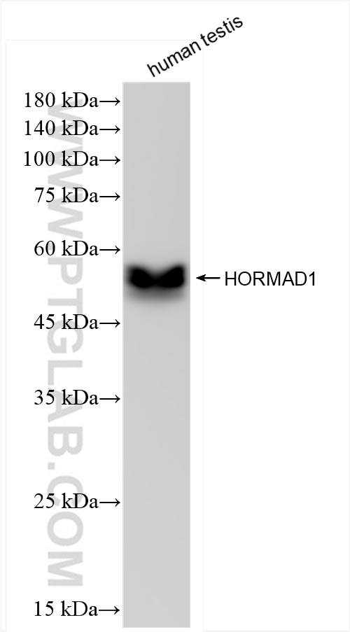 Western Blot (WB) analysis of human testis tissue using HORMAD1 Recombinant antibody (84003-5-RR)