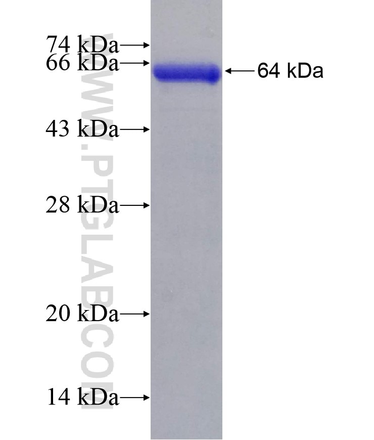 HORMAD1 fusion protein Ag28316 SDS-PAGE