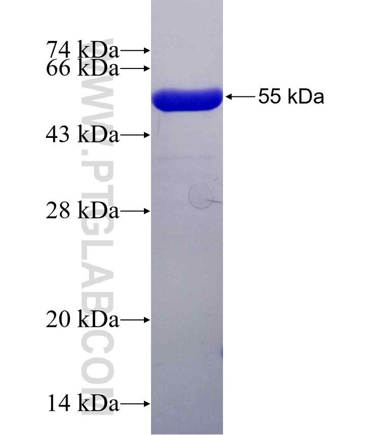 HORMAD1 fusion protein Ag29859 SDS-PAGE