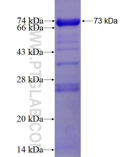 HORMAD1 fusion protein Ag4914 SDS-PAGE