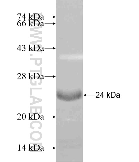 HORMAD2 fusion protein Ag19753 SDS-PAGE