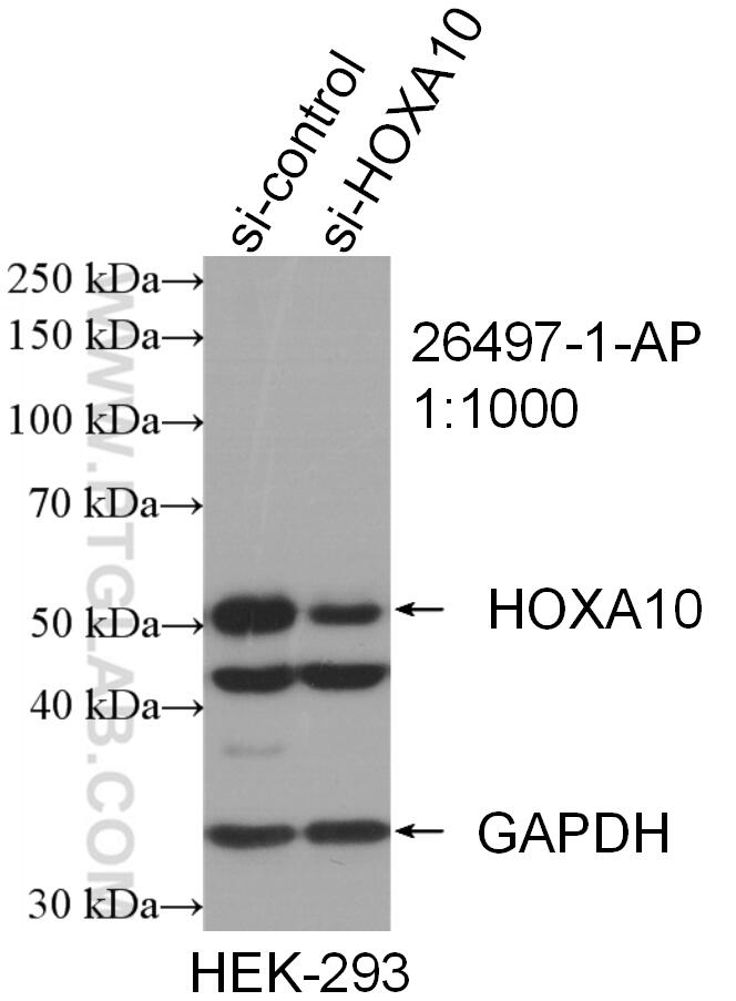 HOXA10