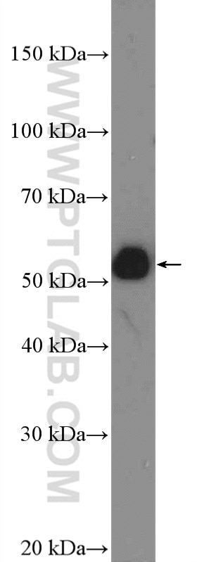 Western Blot (WB) analysis of HEK-293 cells using HOXA10 Polyclonal antibody (26497-1-AP)