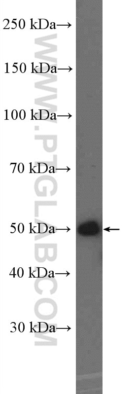 Western Blot (WB) analysis of HeLa cells using HOXA10 Polyclonal antibody (26497-1-AP)
